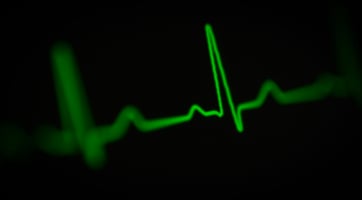heart monitor